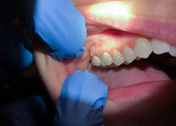 Best Cracked Tooth Emergency Dentist  in Sandpoint, ID